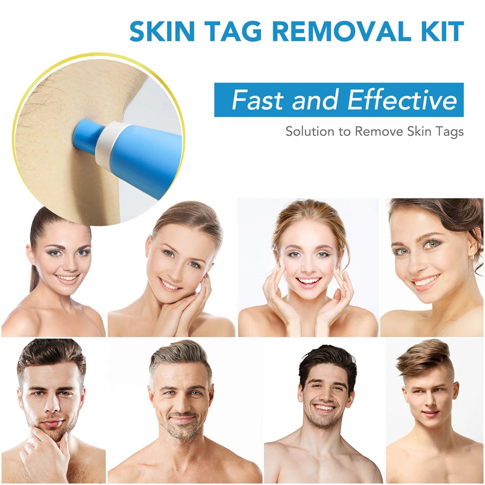 ✅ Skin Tag Remover Kit (2-in-1 Complete Set) – Say Goodbye to Skin Tags Painlessly & Naturally