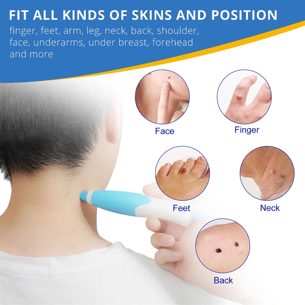 ✅ Skin Tag Remover Kit (2-in-1 Complete Set) – Say Goodbye to Skin Tags Painlessly & Naturally