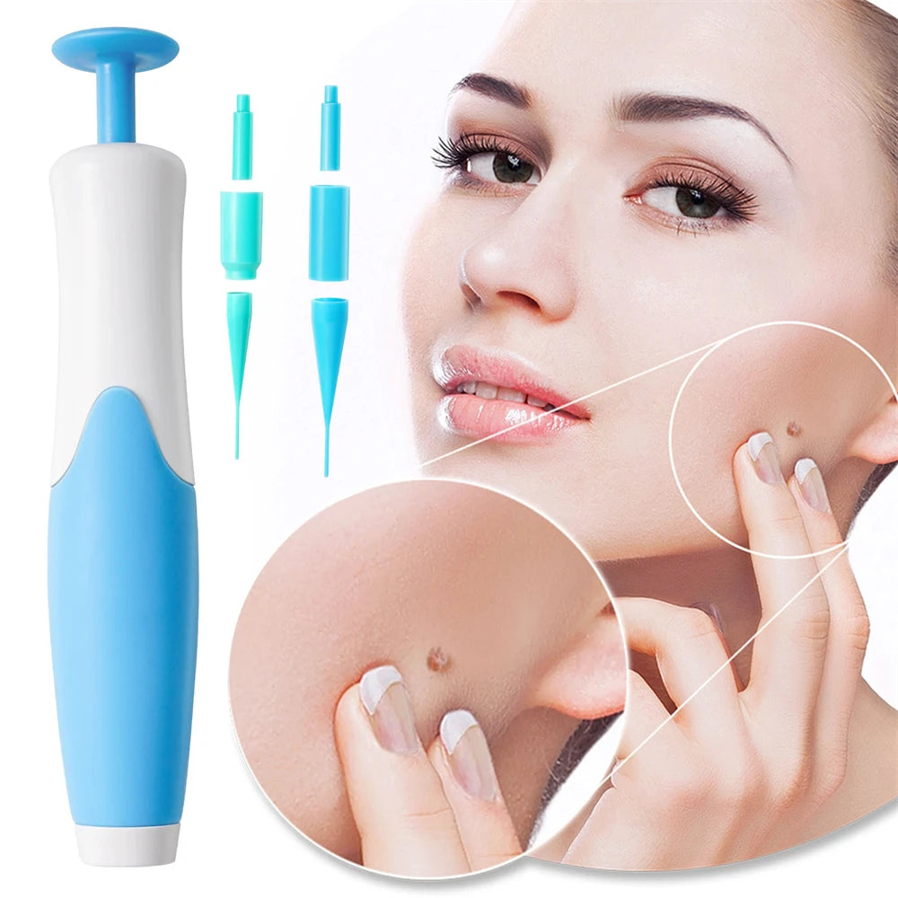 ✅ Skin Tag Remover Kit (2-in-1 Complete Set) – Say Goodbye to Skin Tags Painlessly & Naturally